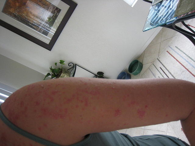 aren't my arms pretty