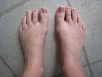 Feet on Wednesday - lots of little bumps